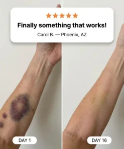 Coredew® Bruise Repair & Skin-Strengthening Cream