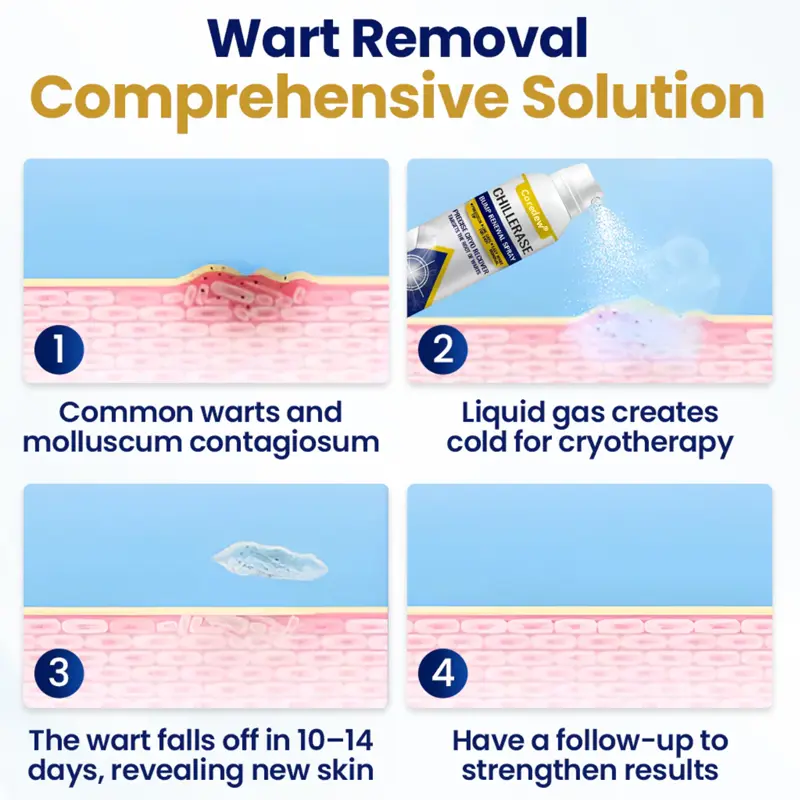 Coredew® ChillErase Bump Renewal Spray