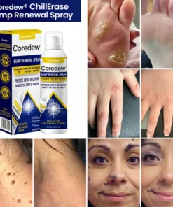 Coredew® ChillErase Bump Renewal Spray
