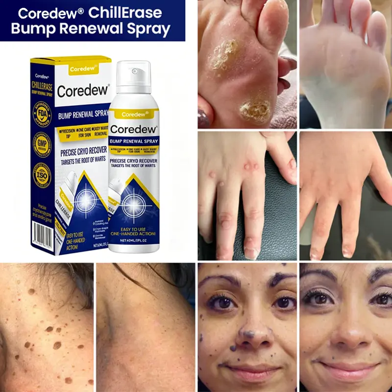 Coredew® ChillErase Bump Renewal Spray