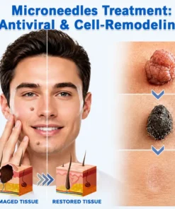 Coredew®2-in-1 Microneedle & Hydrocolloid Patch